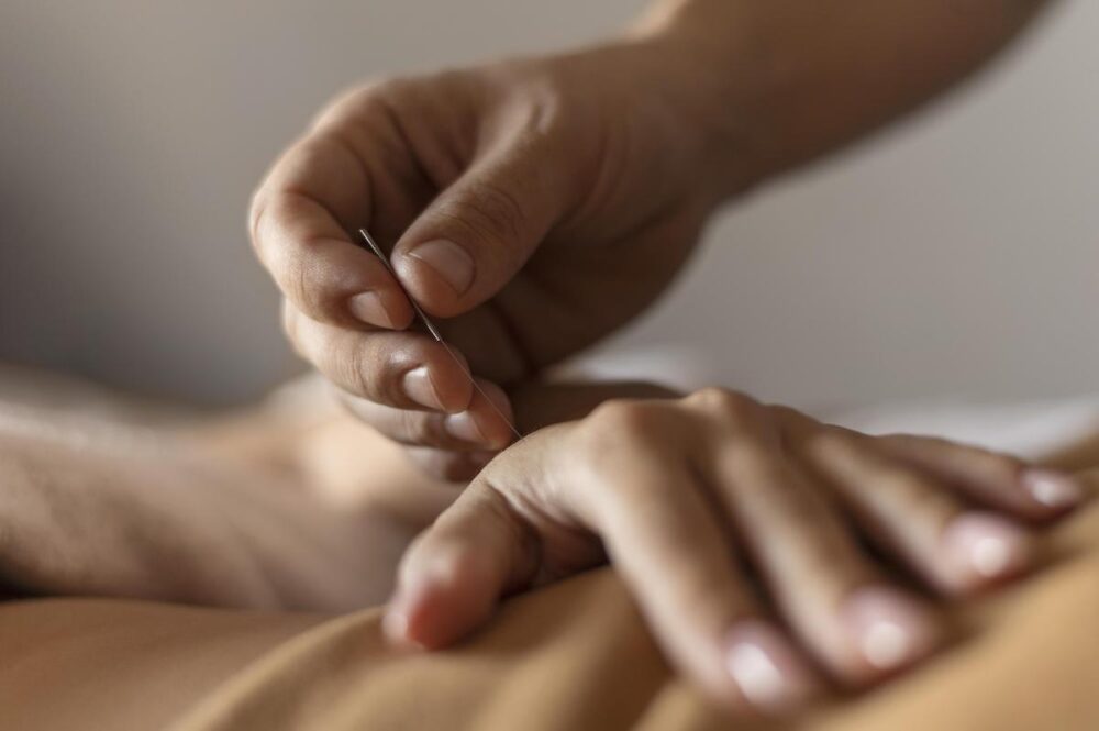 acupuncturist needling a hand in boulder, co
